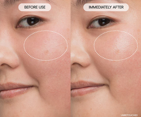 Laneige - Water Bank Blue Hyaluronic Intensive Moisturizer (50ml)